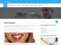 dentalimplants-uk.co.uk Thumbnail