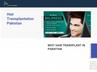 hairtransplantationpakistan.com Thumbnail
