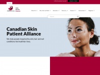 skinpatientalliance.ca Thumbnail