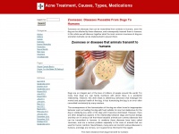 acnetreatment-methods.com Thumbnail