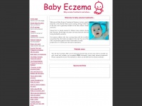 babyeczematreatments.com