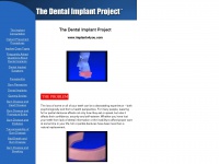 implants4you.com