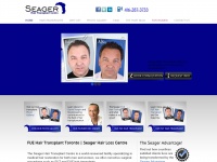 seagerhairtransplant.com
