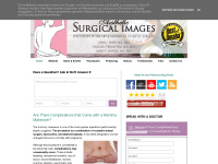 surgicalimagesomaha.blogspot.com Thumbnail