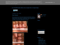 lacquerslacker.blogspot.com Thumbnail