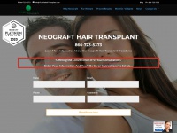 virginiahairtransplant.com Thumbnail