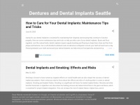 Dentureseattle.blogspot.com